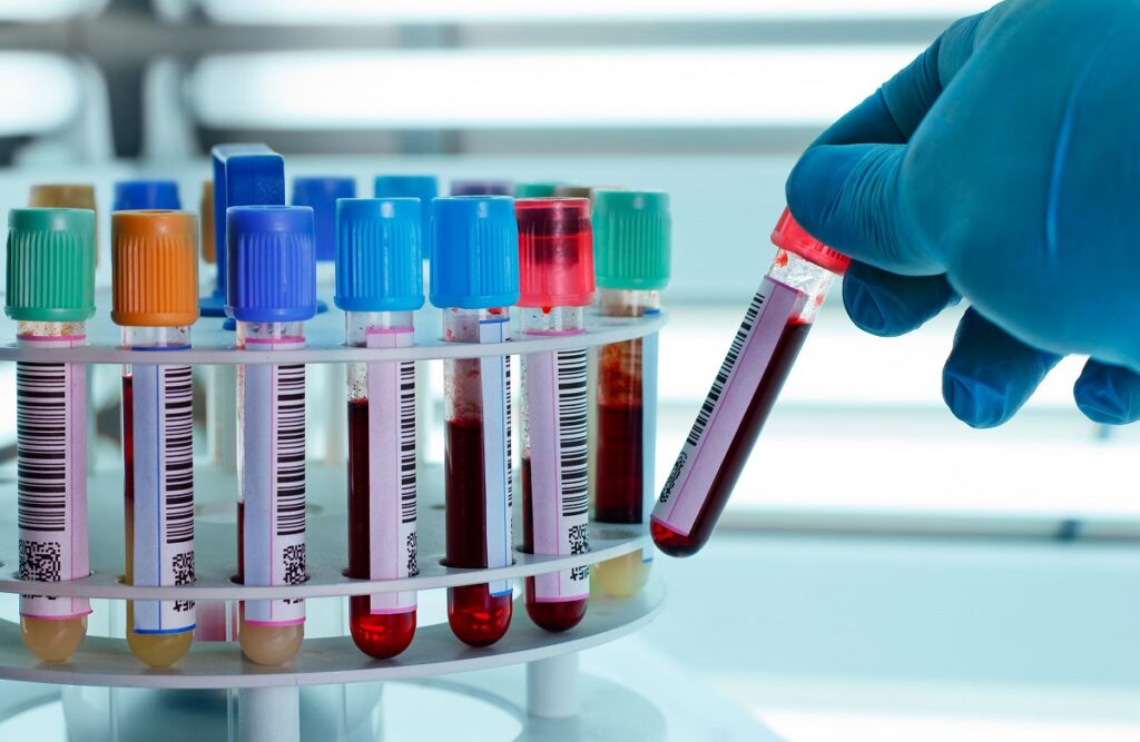 Ordonnance IST pourquoi est-ce obligatoire