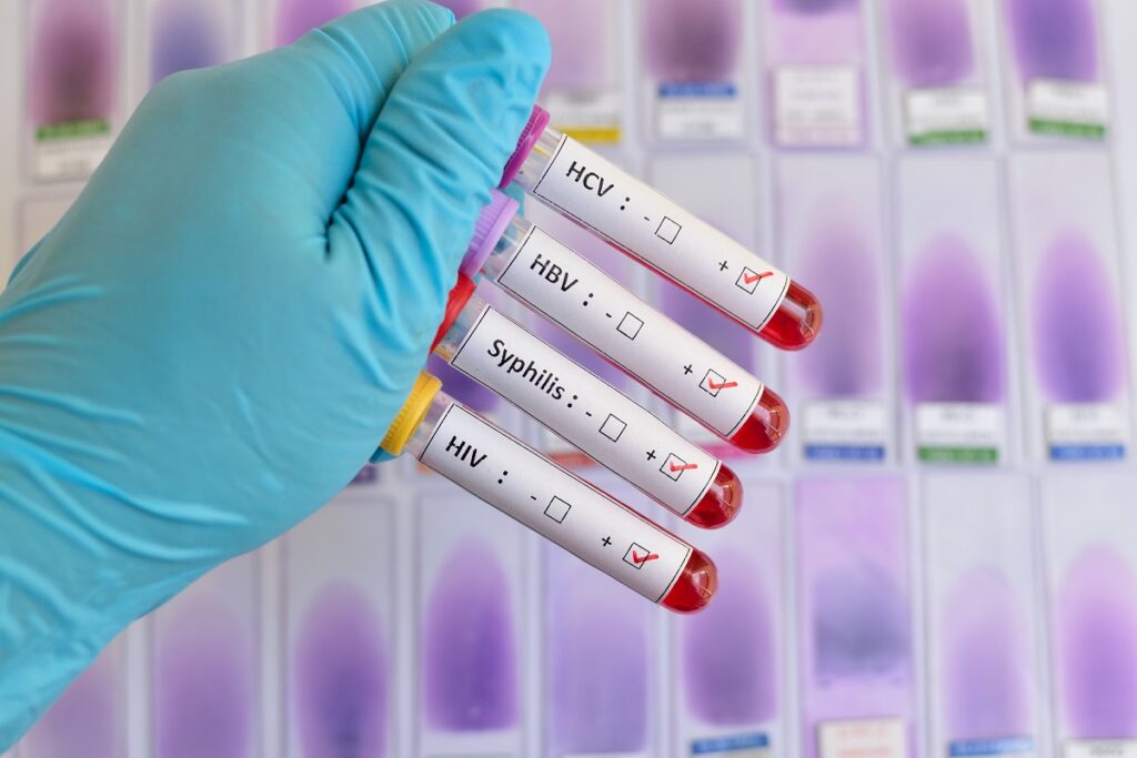 Quels sont les types d’ordonnance IST exigée