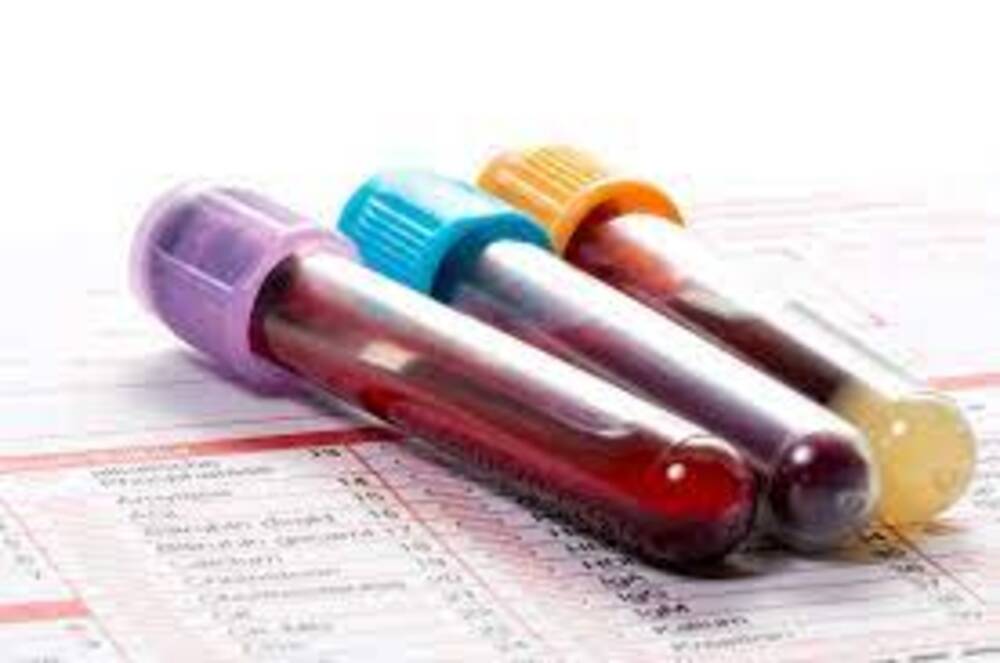 Peut-on obtenir une ordonnance pour dosage de hCG en ligne ?