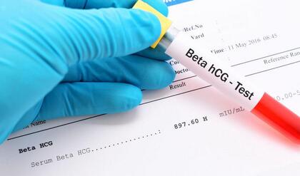 123 m hcg bloedtest 2022 1