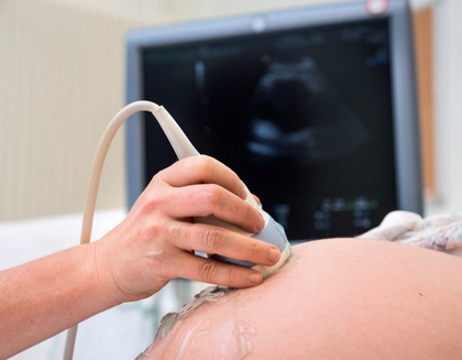 couverture brochure depistage prenatal trisomies 1
