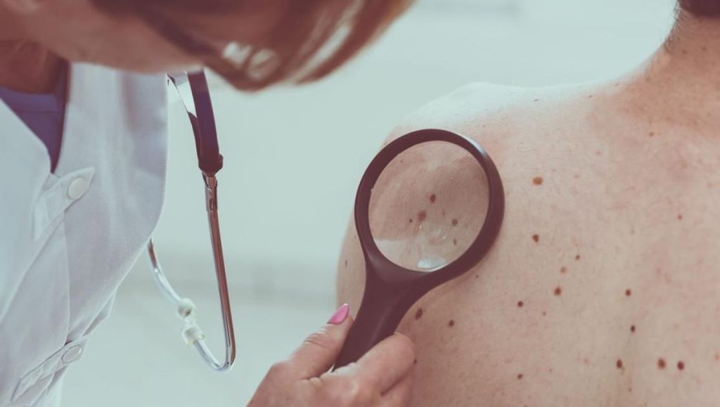 Faut-il une ordonnance pour un dermatologue ?
