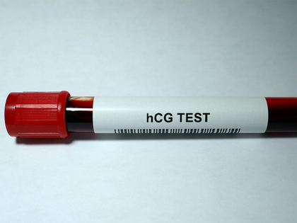 how hcg levels affect pregnancy 1280x960 1