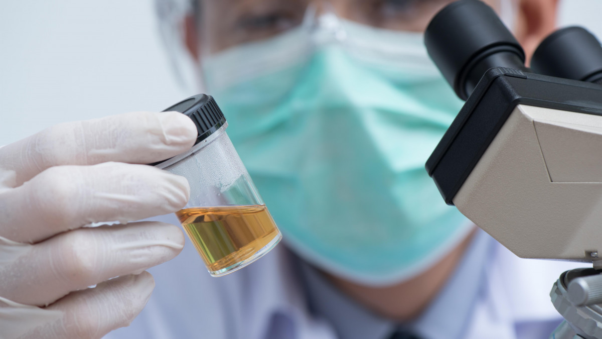 ECBU sans ordonnance : est-ce possible ? Combien cela coûte-t-il ?