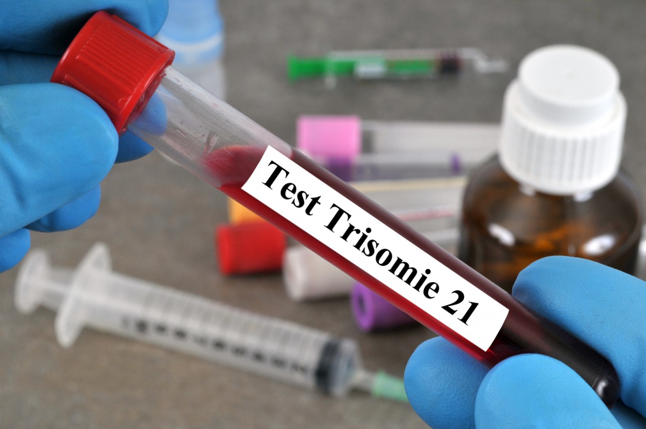 Peut-on faire un DPNI sans ordonnance ?