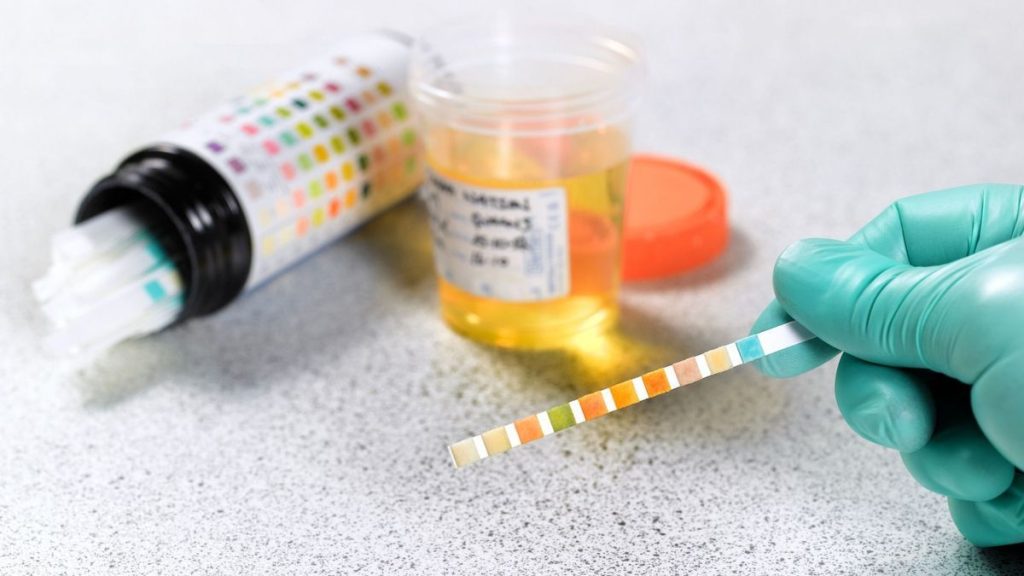 Comment obtenir une ordonnance pour soigner une infection urinaire ?