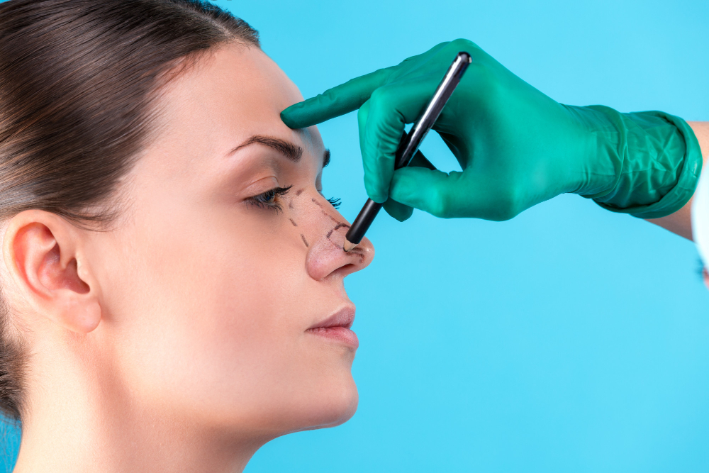 La rhinoplastie ultrasonique : la nouvelle référence pour remodeler le nez